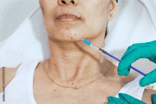 Close-up of a woman receiving a cosmetic chin injection in a clinic, with gloved hands and syringe visible, showing facial treatment, skin care, and non surgical beauty procedure.