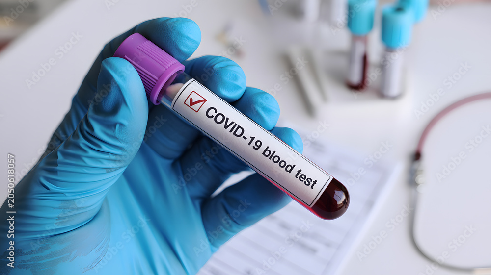Obraz premium A gloved hand holding a COVID-19 blood test tube in a medical laboratory setting