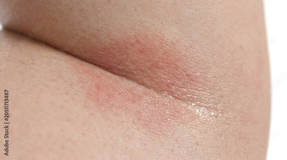 Fototapeta premium Closeup view of human skin texture on elbow area highlighting various skin tones imperfections and natural features with a smooth finish and subtle details visible in high resolution