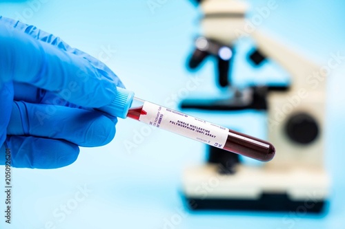 Detects genetic variations across the genome, useful for