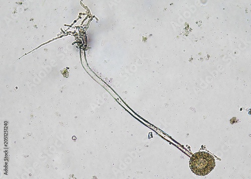 soil microorganisms under a microscope including amoeba, flagellates, nematodes, fungi, bacteria	