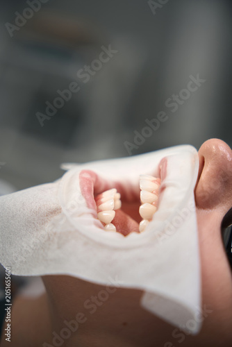 Foto Adult person in dental office with retractor under daylight