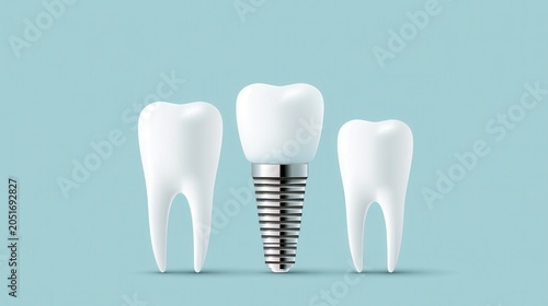 3D illustration of a dental implant placed between two natural teeth, showcasing dental restoration and prosthetic dentistry on a light blue background.