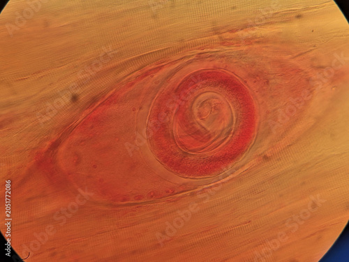 Trichinella spiralis Encysted Larva in Muscle Tissue Showing Nurse Cell Capsule Under Light