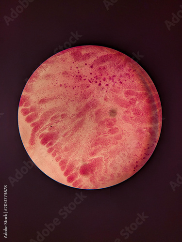 Schilderij op canvas Hymenolepis nana Mature Proglottid Showing Testes Ovary and Genital Pore Under M