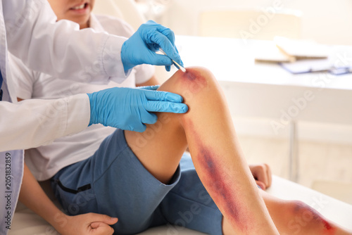 Female doctor treating little boy's wounded leg in clinic, closeup