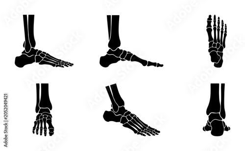 Quadro su tela Human foot and ankle bones anatomy illustration set, different views, black silh