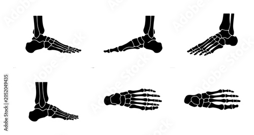 Cuadro en lienzo Black silhouette of human foot bones in different views Vector