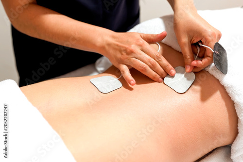 Therapist applying electrical stimulation pads to a woman's lower back