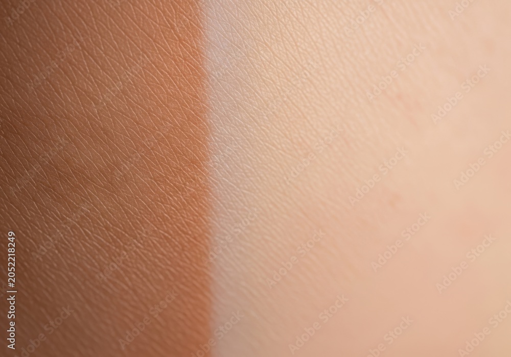 Fototapeta premium Closeup view of human skin showing a comparison between a dry and a moisturized section