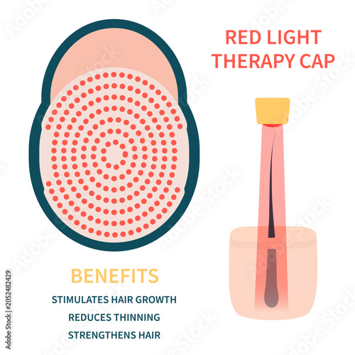 Red light therapy hair cap with circular diode layout for follicle growth and alopecia treatment. Vector illustration.