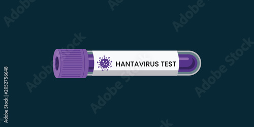 Konstfotografi Purple cap holds test tube for hantavirus screening