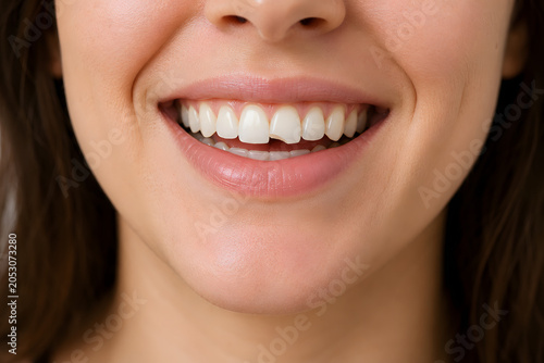 Chipped Front Tooth in Woman's Smile – Cosmetic Dentistry, Dental Bonding & Tooth Repair