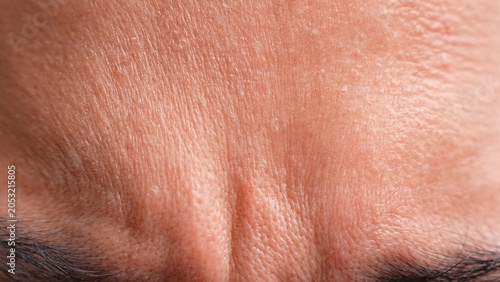 Tableau sur toile A person’s brows are furrowed intensely, expressing deep concern