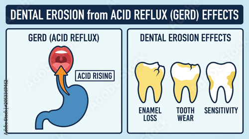 Bild auf Leinwand Dental Erosion from Acid Reflux GERD Effects