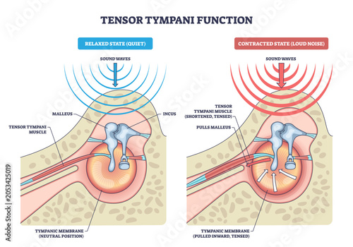 Fotografie Tensor tympani function, relaxed vs contracted states show the muscle pulling the malleus to tense the tympanic membrane and protect hearing, tensor tympani, malleus, eardrum, transparent background