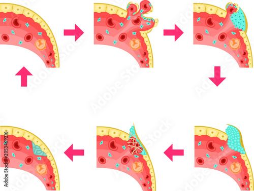 Bild auf Leinwand Homostasis and Vascular Repair Process:Platelet Adhesion, Aggregation and Blood