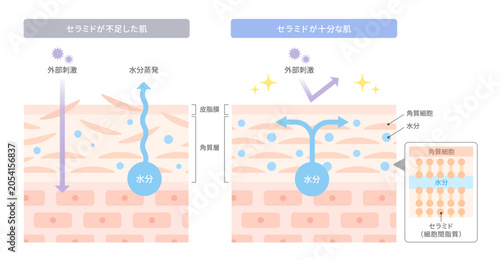 Foto セラミド不足の肌とセラミドが十分な肌の比較イラスト｜肌の保湿機能を解説する断面図