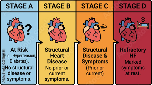 Photos Heart Failure Stages A through D Classification Chart