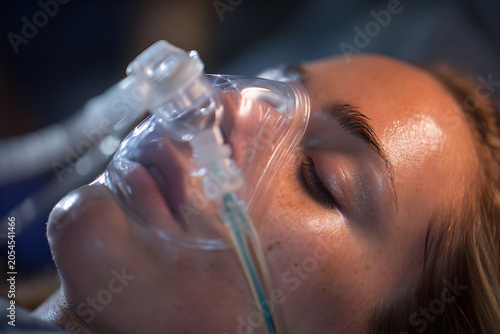 Close-up of a patients face with an oxygen mask during a medical procedure.