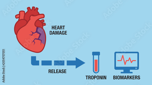 Foto Cardiac Biomarkers Troponin Release in Heart Damage Vector