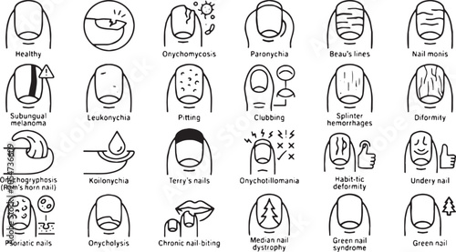 Nail Diseases, Dermatology Disorders, and Finger Nail Conditions Vector Line Icons Set (Includes Onychomycosis, Subungual Melanoma, Paronychia, Koilonychia, and Chronic Nail Biting Concepts)