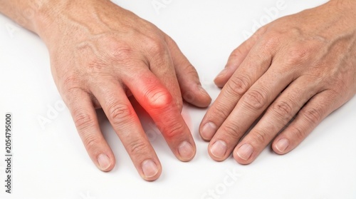 Close-up of hands showing joint inflammation and redness medical condition on skin