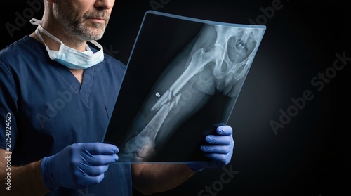Doctor examining a broken arm xray image in a dark room.