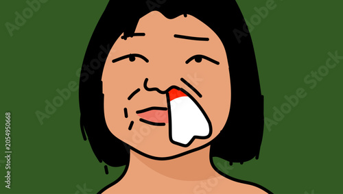 Bild auf Leinwand Nosebleed in a child, color vector illustration