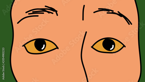 Konstfotografi Man's face with jaundice, color vector illustration