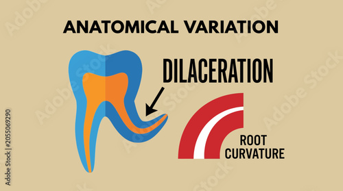 Foto Dilaceration Root Curvature Anatomical Variation