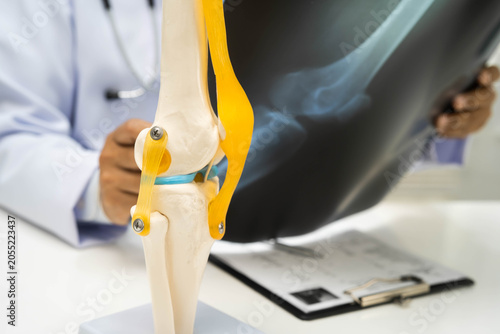 Konstfotografi Doctor examining knee joint bone radiography xray film.