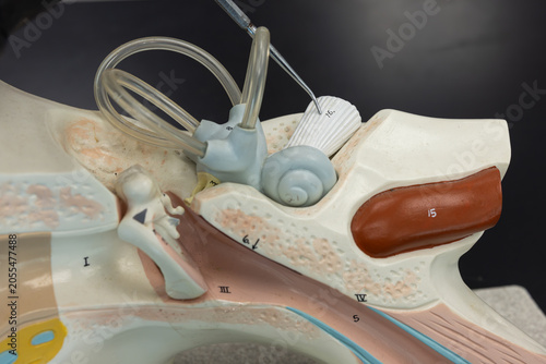 Pointer Showing The Vestibulocochlear Nerve On Ear Anatomy Model