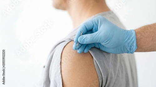 A professional physical therapist performing dry needling or acupuncture treatment on a male patient's shoulder in a clinical setting.