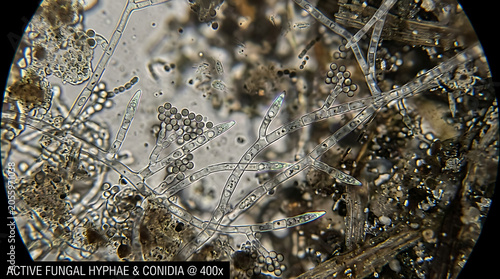 Microscopic view of active fungal hyphae and conidia in a laboratory setting with various microorganisms.
