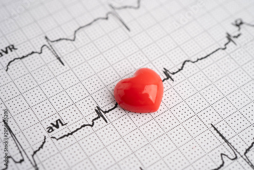 Electrocardiogram ECG, heart wave, heart attack, cardiogram report.
