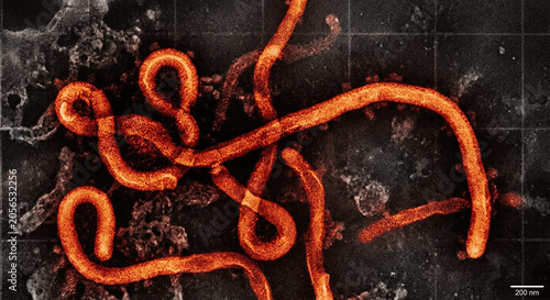 Microscopic view of Ebola virus string cells and orange particles on high‑contrast background – virology research, infectious disease, medical illustration, pathogen visualization, scientific, labs