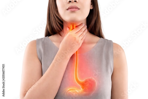 Woman Suffering From Acid Reflux Heartburn Gastroesophageal Disease With Inflamed Esophagus and Stomach Digestive Discomfort Isolated on White Background