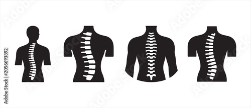 Human Spine Anatomy Icons Set Showing Different Posture Alignment and Spinal Curvature Conditions.