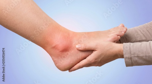 Painful ankle sprain with red inflammation and swelling being examined by hands against a light blue background surface