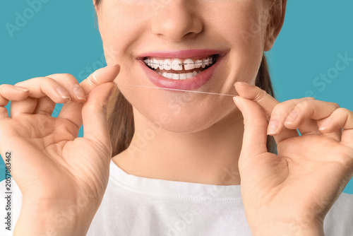 Tableau sur toile Beautiful young woman with dental braces and floss on blue background, closeup