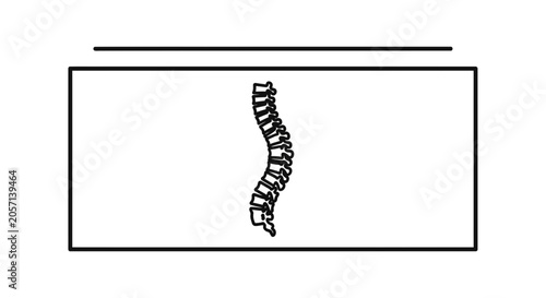 Spine X-ray Image: Scoliosis Curvature, Medical Illustration, Healthcare Concept