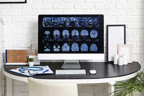 Medical brain scan display ...