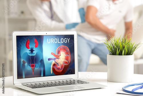 Open laptop on table at urologists office, closeup