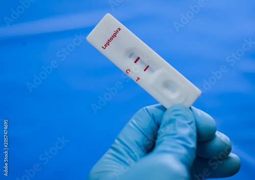 Obraz na plátně Blood sample of patient positive result for leishmania.