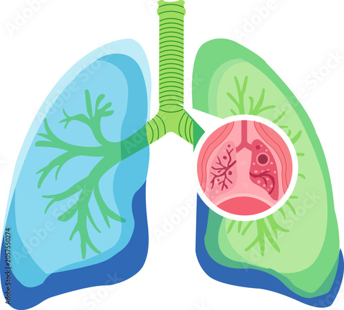 Foto Illustration of human lungs with a magnified view of lung tissue
