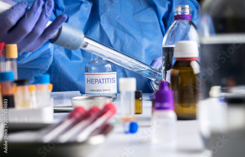Cuadro en lienzo A scientist takes samples for hepatitis research in a laboratory, conceptual ima