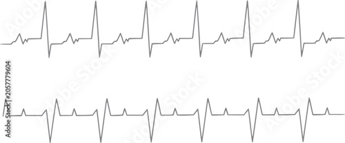 Cuadro en lienzo Two electrocardiogram (ecg) waveforms displayed side-by-side on a white backgrou