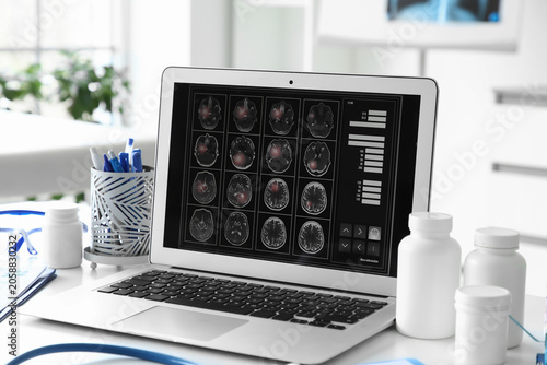 Medical laptop displaying b...