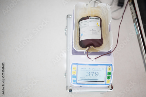 Selective focus blood bag from donor while donating blood at blood bank unit in hospital.Donation for emergency surgery at donation center.Save life and medical concept.